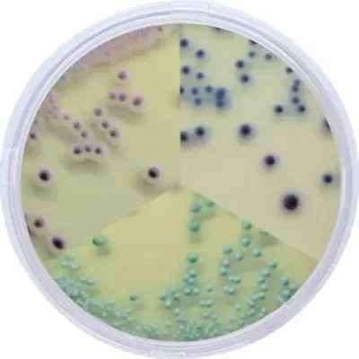 Chromogenic Candida Agar
