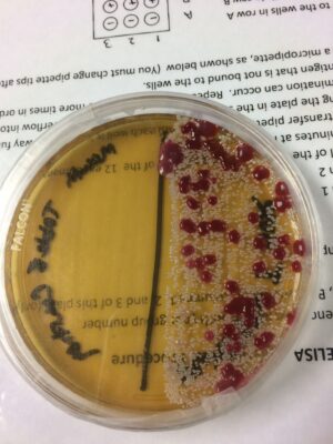 Tomato Juice Agar Base