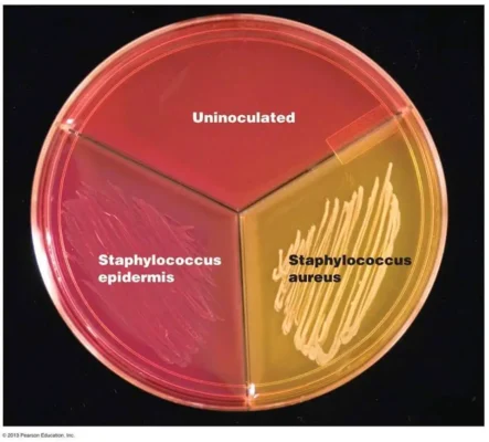 Mannitol Salt Agar