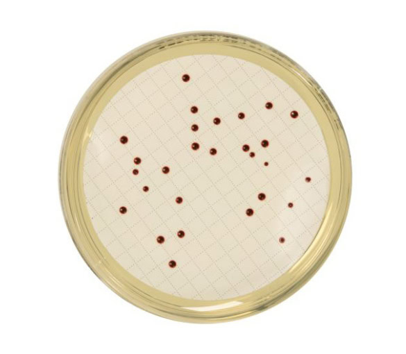 7 Kegunaan Slanetz Bartley Agar & Cara Pakai yang Benar 1 Slanetz Bartley Agar