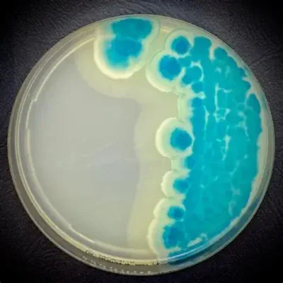 Bacillus Cereus Chromogenic Medium
