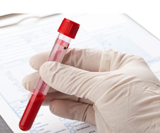 FineQuick Blood Genomic DNA Kit: 5 Keunggulan Utama 1 FineQuick Blood Genomic DNA Kit