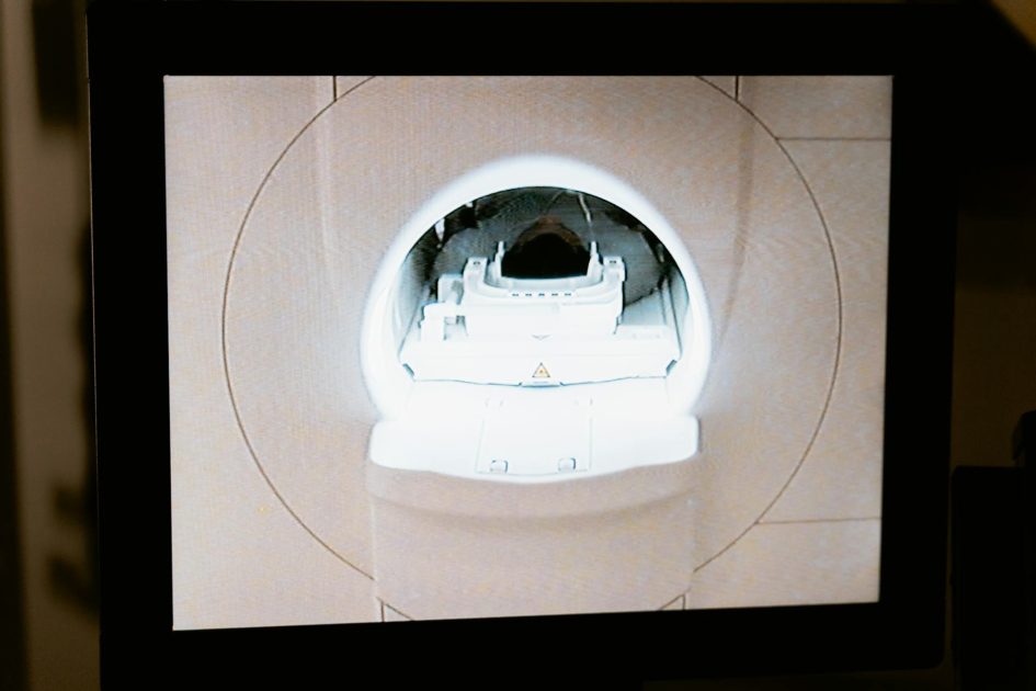 Medical Display Monitor Radiologi: 7 Panduan Lengkap Memilih Terbaik 1 Close-up of an MRI scanner displayed on a monitor in a medical clinic.