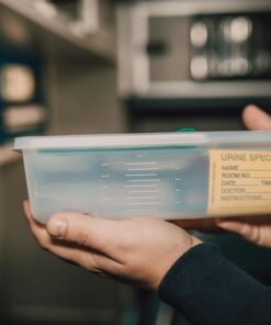 Close-up of hands holding a urine specimen container in a lab environment.