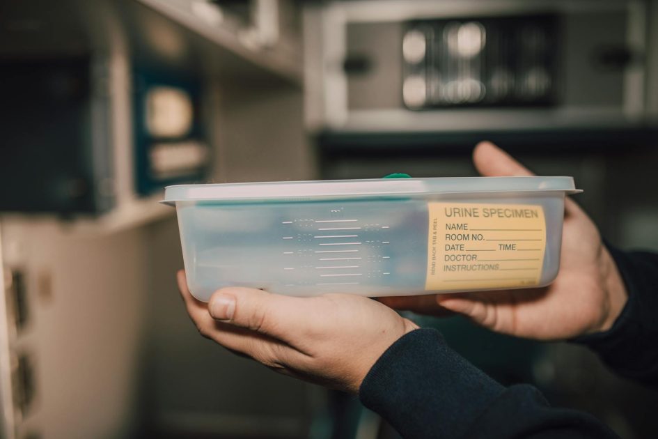 Corning Gosselin Pot 30 mL PP - RDNE Stock project Close-up of hands holding a urine specimen container in a lab environment.