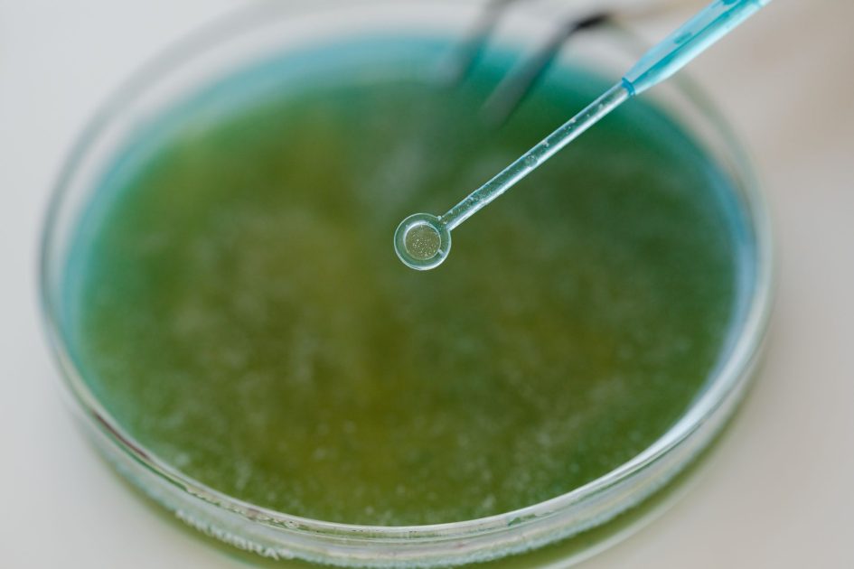 MRS Medium: Panduan Lengkap Media Kultur 2024 1 Detailed view of a pipette interacting with a green sample in a petri dish, ideal for scientific content.
