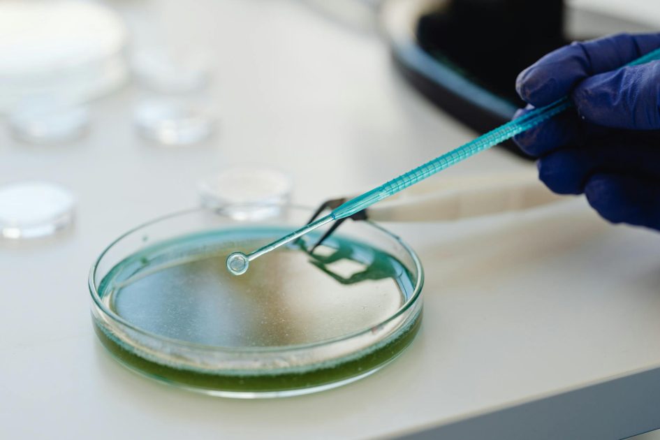5 Kegunaan Membrane Lauryl Sulphate Broth & Cara Pakainya 1 Scientist conducting an experiment with a pipette and petri dish in a lab.