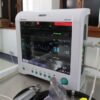 Close-up of an advanced medical monitor displaying ECG data in a clinic.