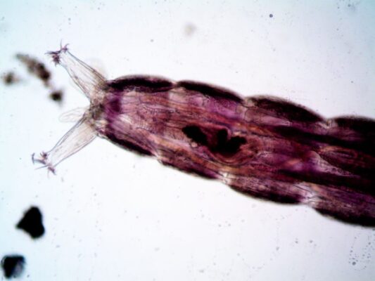 Detailed view of a rotifer, showcasing its intricate structure and features.