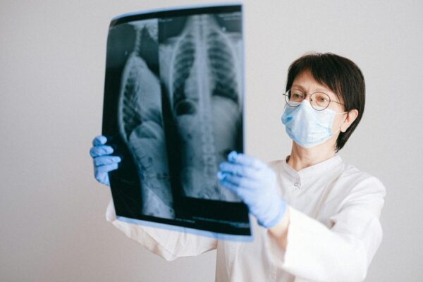 Doctor in protective gear examining chest x-ray for diagnosis.