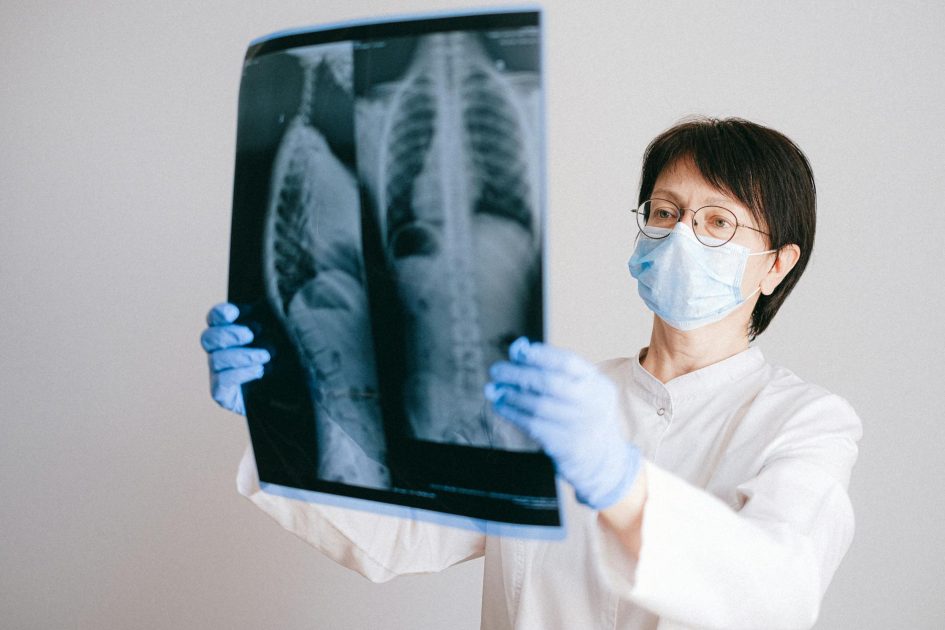 Automatic Processing Film: Panduan Lengkap 2024 1 Doctor in protective gear examining chest x-ray for diagnosis.