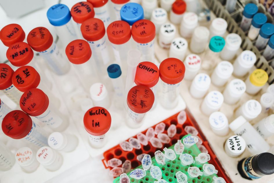 botol HDPE 1 liter laboratorium - Polina Tankilevitch Lab test tubes and bottles with colorful caps and labels seen from above in a scientific setting.
