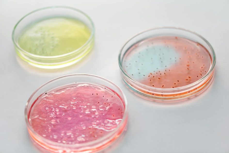 7 Kegunaan Brilliant Green Phenol Red Agar & Cara Pakainya 1 Close-up of colorful petri dishes with microbes for scientific research.