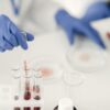 A scientist using pipette for chemical analysis in a laboratory with test tubes and protective gloves.