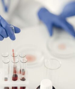 A scientist using pipette for chemical analysis in a laboratory with test tubes and protective gloves.