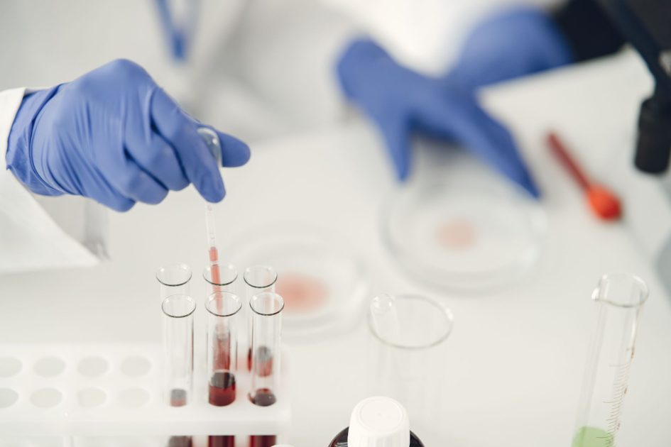 pipet serologi laboratorium - Gustavo Fring A scientist using pipette for chemical analysis in a laboratory with test tubes and protective gloves.