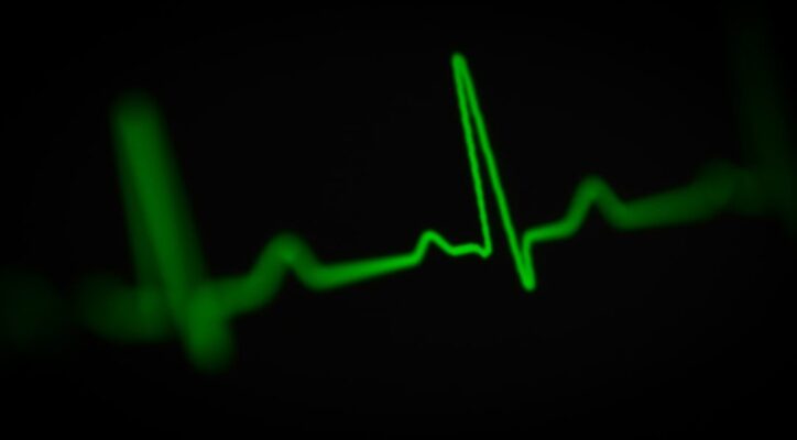 a green heart beat on a black background