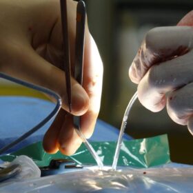 Tak Perlu Luar Negeri Dokter: 9 Panduan Lengkap Perawatan Saraf 2025