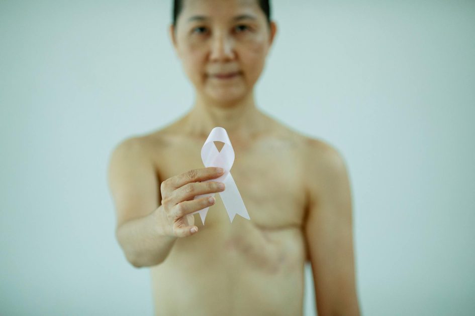 Teknologi Women's Health: 5 Fitur Canggih untuk Kesehatan Wanita 1 Crop naked unrecognizable female with surgery scarring demonstrating symbol of breast cancer awareness
