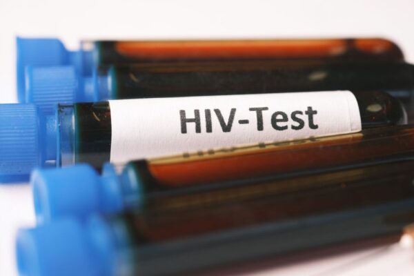 A detailed close-up image showing blood samples labeled for HIV testing.