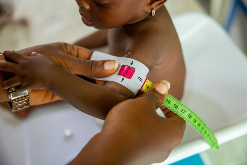 BPOM Ingatkan Investasi Gizi Kesehatan: 7 Langkah Praktis 2024 1 A healthcare professional measures a child's arm using MUAC tape for malnutrition assessment.