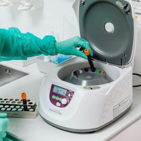 Wanita BB 300 Kg Sragen: 9 Panduan Kesehatan & Pencegahan 5 Import Alat Lab ke Indonesia: 12 Pertanyaan Sering Dijawab