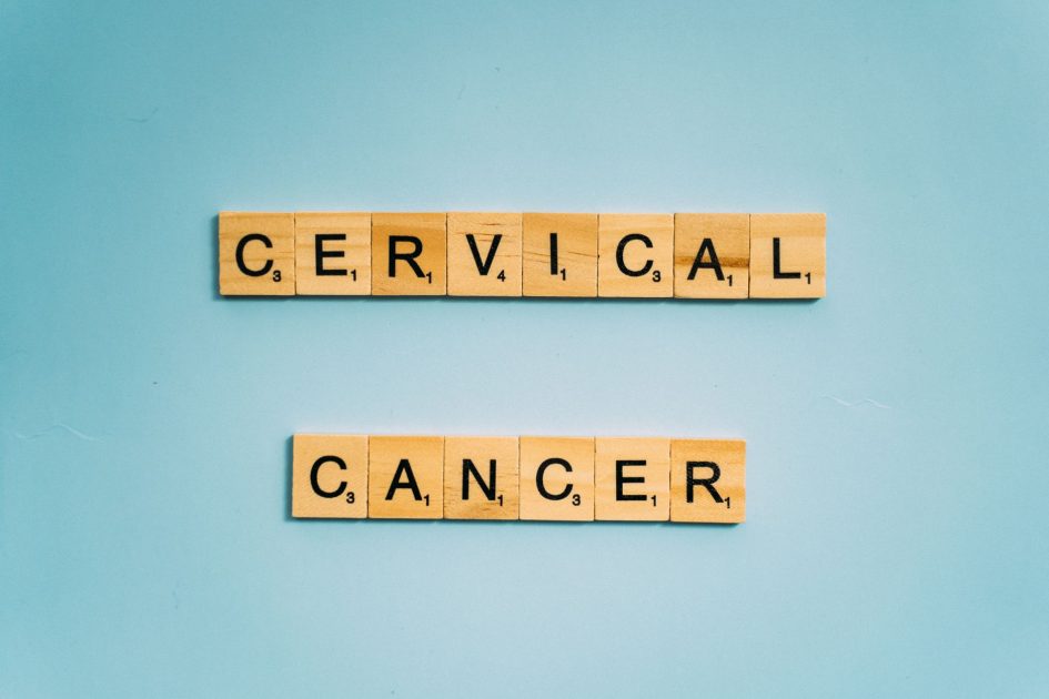 Cegah Kanker Serviks Sejak Dini: 7 Langkah Praktis 2025 1 Scrabble tiles spelling 'Cervical Cancer' on a light blue background for awareness.