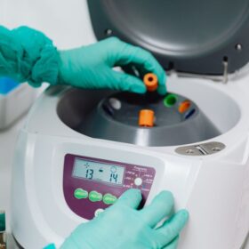 7 Tipe Centrifuge Laboratorium Pilihan Terbaik 2025: Hettich vs Global