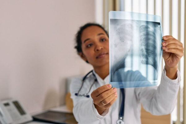 Healthcare professional analyzing chest X-ray in modern medical office.