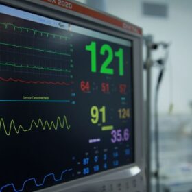 RSUD Murjani Ajukan Rp12 Miliar: Panduan Alkes Jantung & NICU