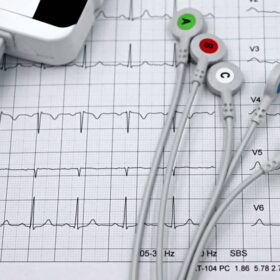 Sempat Didiagnosis Serangan Panik Wanita: 7 Panduan Lengkap