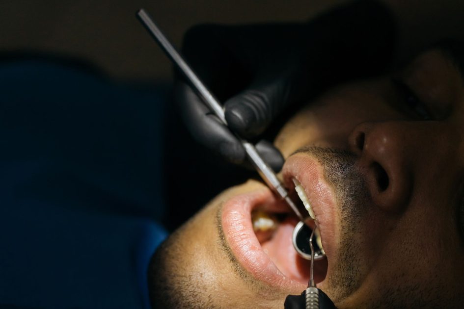 Detailed close-up of a dental examination with instruments in a clinical setting.