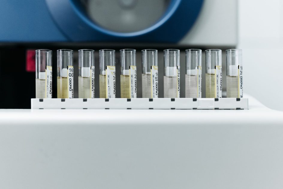 Minor 200 vs Octagon 200: Pilih Sieve Shaker Mana untuk Lab? 1 Row of labeled test tubes on a rack in a modern laboratory environment.
