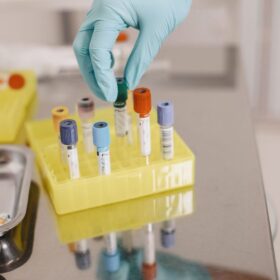 BPOM Pastikan Tetap Kawal MBG: Panduan Lengkap 2025 4 Wabah Salmonella Menyebar AS: 7 Langkah Pencegahan Praktis