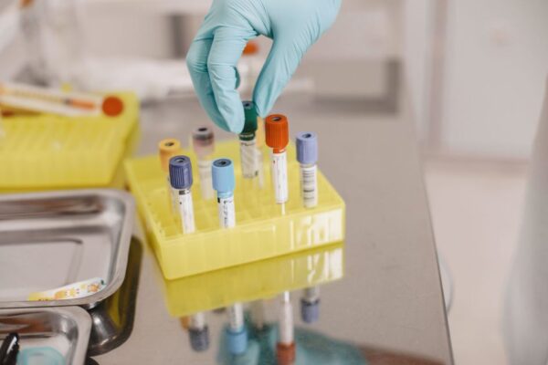 A gloved hand handling vials in a laboratory setting, emphasizing safety and precision.
