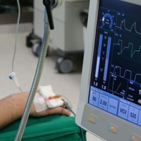 Analisis Partikel Farmasi: Teknologi & Tools 2025 2 Alat Kesehatan ICU RSUD Disorot: 9 Peralatan Medis Prioritas 2025