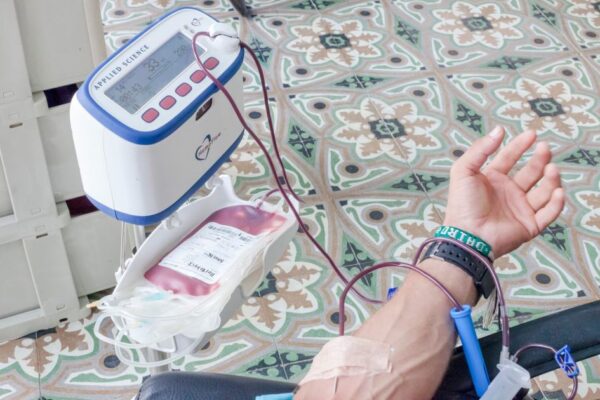 Close-up of a patient's arm during blood donation with medical equipment.