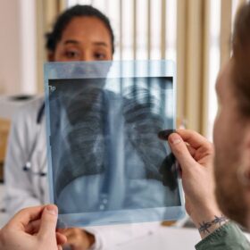 Anak Krakatau Erupsi: 9 Cara Lindungi Diri dari Abu Vulkanik 2 Influenza Tingkatkan Risiko Pneumonia: 7 Fakta Penting & Pencegahan