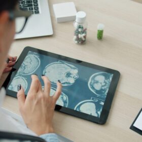 Influencer Tenggak 11 Suplemen Sekali: 7 Fakta & Risiko 4 Neurolog RSCM Buka Suara Kondisi: 7 Fakta & Pencegahan