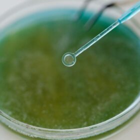 Kemenkes RI Ungkap Super Flu: Panduan Lengkap & Pencegahan 2024 4 Terungkap Pemicu Keracunan MBG Kediri: 7 Langkah Pencegahan E Coli