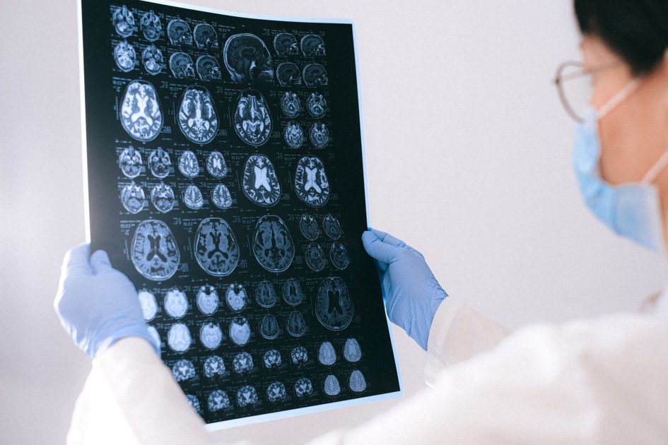 Update Kemenkes Anak Diduga Hilang Ingatan: 9 Fakta & Pencegahan 1 A medical professional reviewing MRI brain scans in a clinical setting, highlighting healthcare technology.