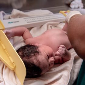 Bayi 24 Hari Diduga Diberi Telur Mentah: 7 Bahaya & Pencegahan