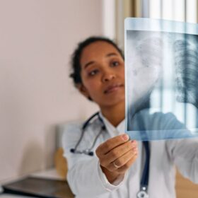 Dokter Paru Beberkan Beda Sesak: 7 Panduan Lengkap Asap vs ISPA