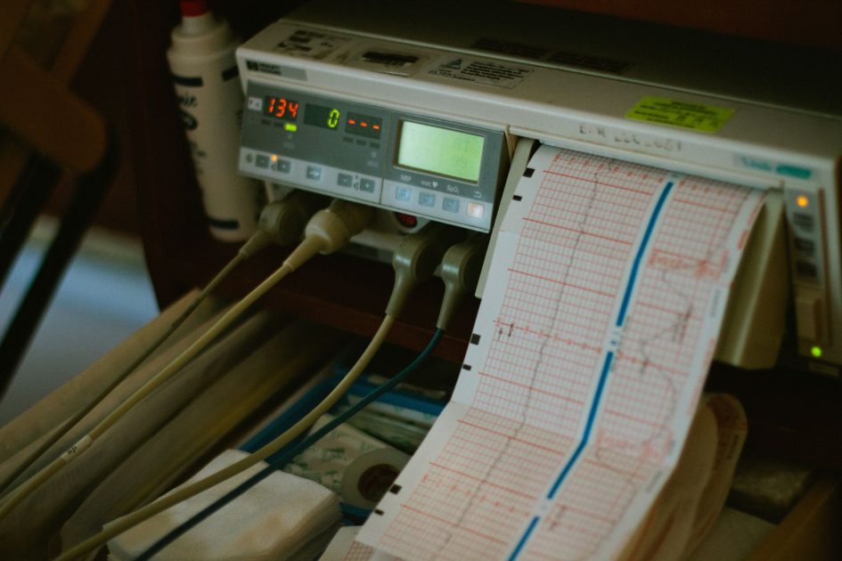 Frisian Flag Ajak Keluarga Beri Perhatian: 7 Panduan Kesehatan Ibu 1 Close-up of an ECG machine displaying heart rate results in a hospital setting.