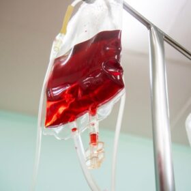 Kabar Baik Terapi Osteoarthritis Berbasis Sel: Panduan 2025