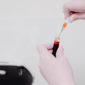 BGN Tegur Karyawan SPPG Bantul: 7 Langkah Profesional 2025 3 Riset Sebut Golongan Darah Berisiko: 7 Fakta Diabetes Tipe 2