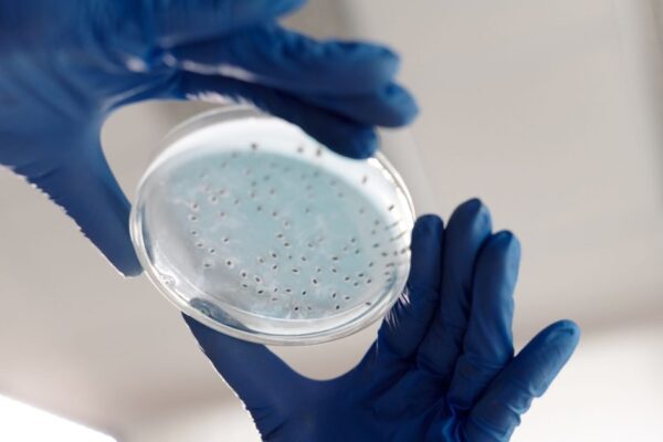 Close-up of hands in gloves holding a petri dish for microbiology analysis in a lab.
