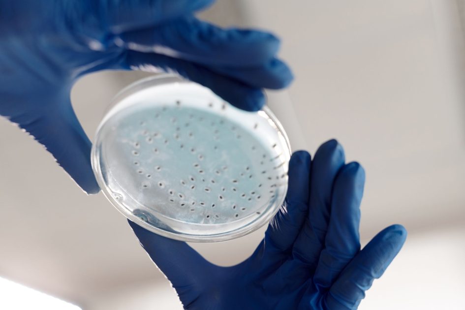 Close-up of hands in gloves holding a petri dish for microbiology analysis in a lab.